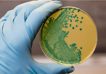 436 Plastic-Eating Microbes, Can They Solve the Plastic Crisis?